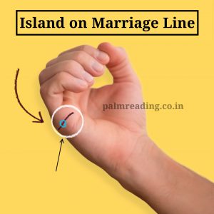 Island on marriage line